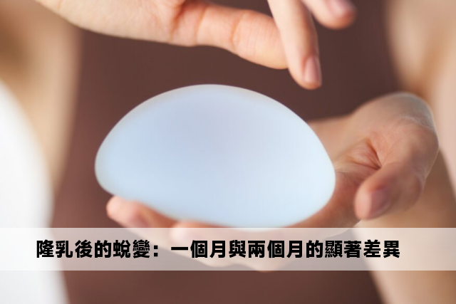 隆乳後的蛻變：一個月與兩個月的顯著差異